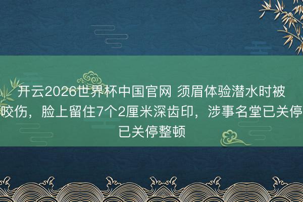 开云2026世界杯中国官网 须眉体验潜水时被鲨鱼咬伤，脸上留住7个2厘米深齿印，涉事名堂已关停整顿